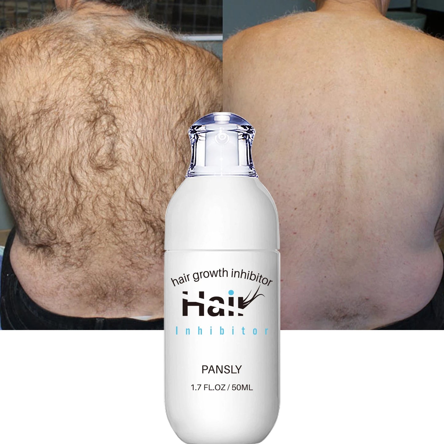 100ML Hair Removal Spray Hair Growth Inhibitor Spray Painless Hair Reduction Permanently Inhibits Hair Growth Skin Silky Smooth Peaceful Pleasures Health and Wellness