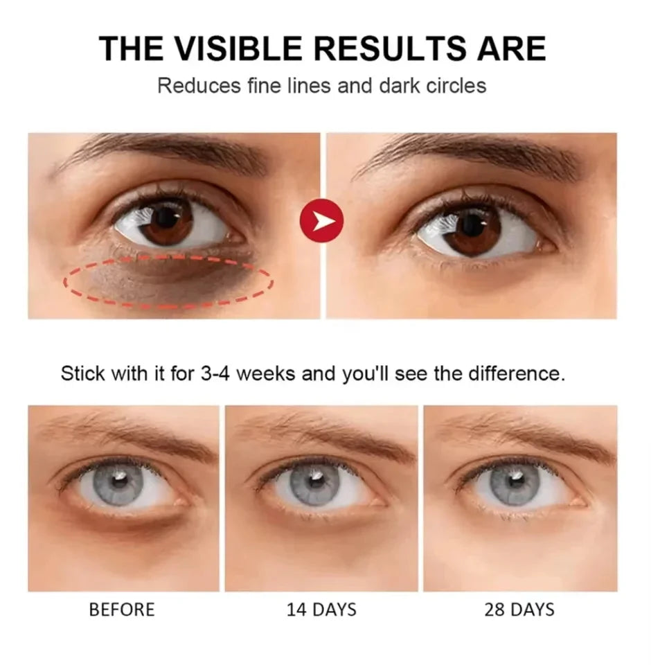 Instant Eye Bag Removal Cream Retinol Anti-Wrinkle Lifting Firming Fade Fine Lines Anti Dark Circle Puffiness Brighten Eye Care Peaceful Pleasures Health and Wellness