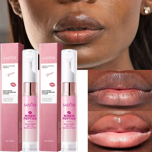 SADOER Lip Lightening Balm – Exfoliating & Brightening Lip Lightening Balm Oasis Select