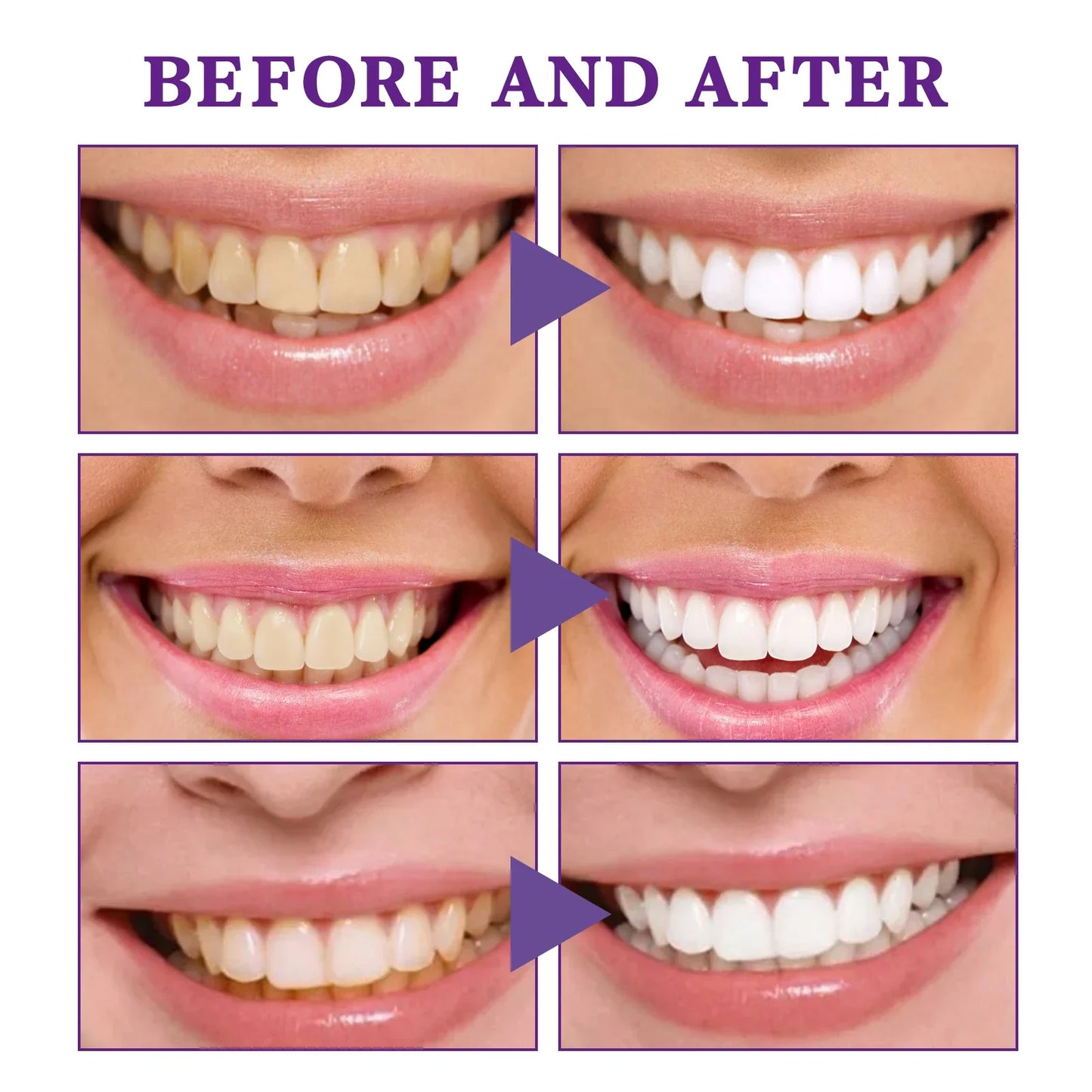 V34 Teeth Whitening Cleansing Mousse – Foam Toothpaste 30ml