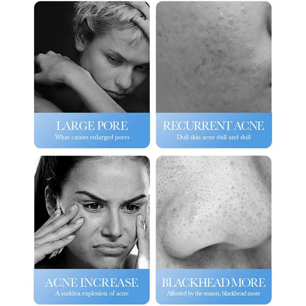 BIOAQUA Salicylic Acid Acne Cream – Oil Control & Pore Minimizer