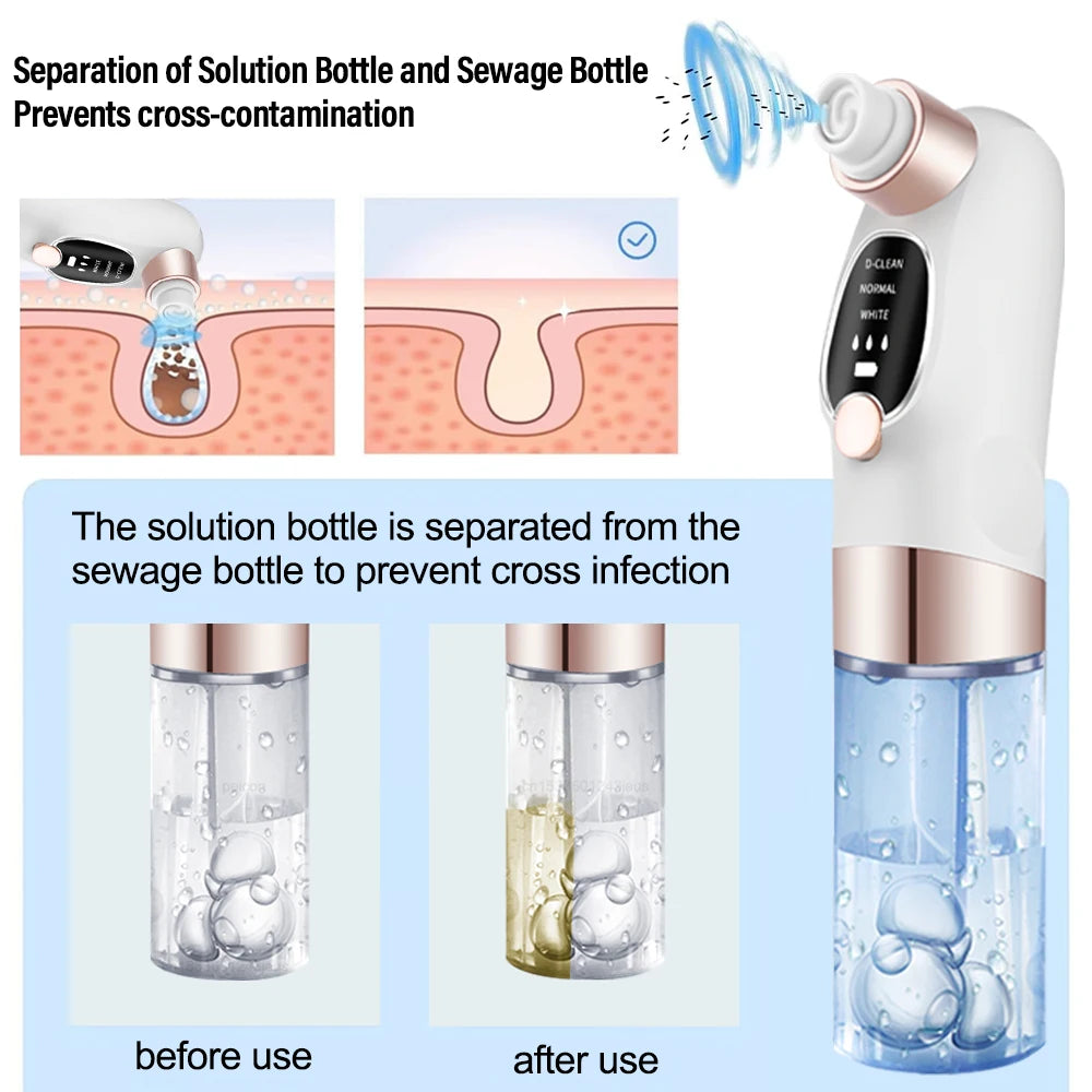 Electric Blackhead Remover Pore Vacuum Cleaner Facial Black Dots Vacuum Cleaner Pimple Acne Blackhead Removal Black Dots Remover Peaceful Pleasures Health and Wellness