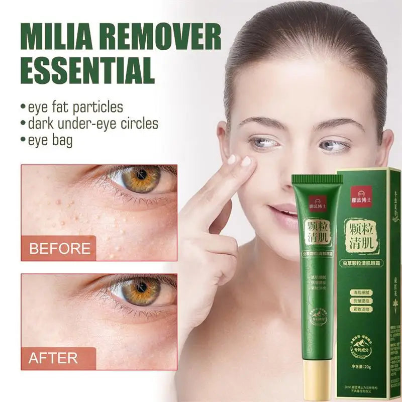Eye Cream for Dark Circles, Puffiness & Fine Lines – 20g