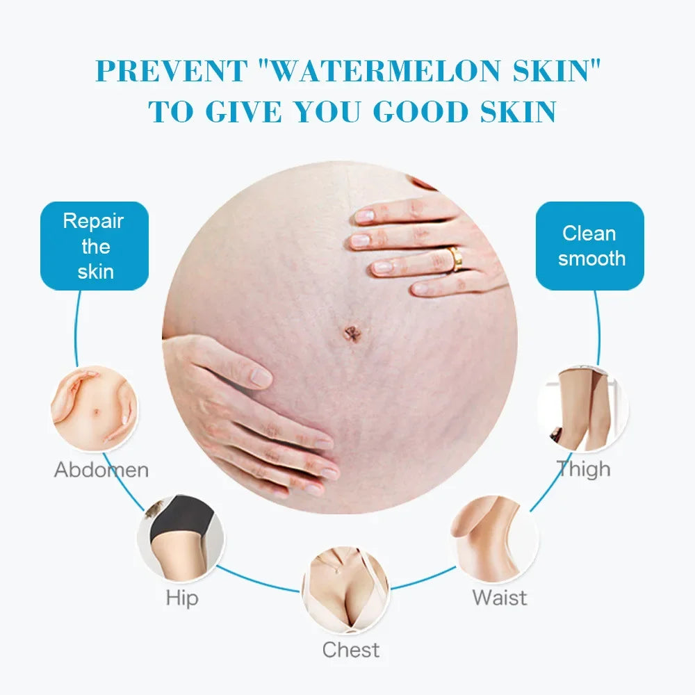 Snail Removes Stretch Mark Cream To Remove Postpartum Obesity Pregnant Women Repair Anti-Aging Anti-Winkles Firming Body Cream Peaceful Pleasures Health and Wellness