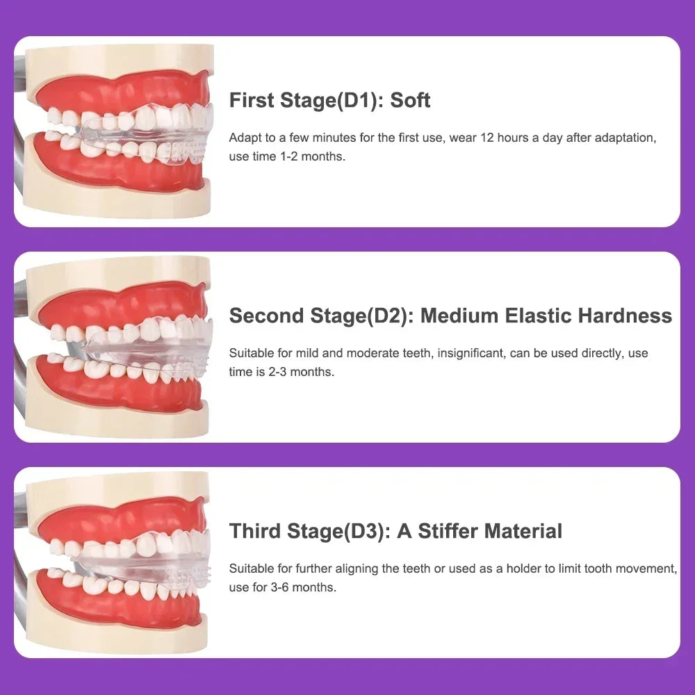 3-Stage Transparent Teeth Aligners - Orthodontic Dental Braces for Adults, DIY Tooth Straightening Corrector Kit Peaceful Pleasures Health and Wellness
