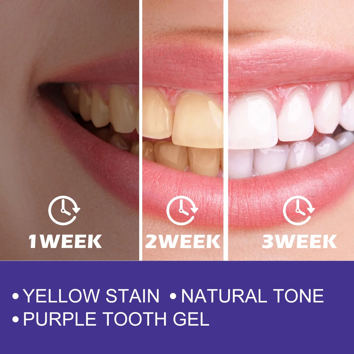 V34 Color-Correcting Whitening Toothpaste | Brighter Smile Daily