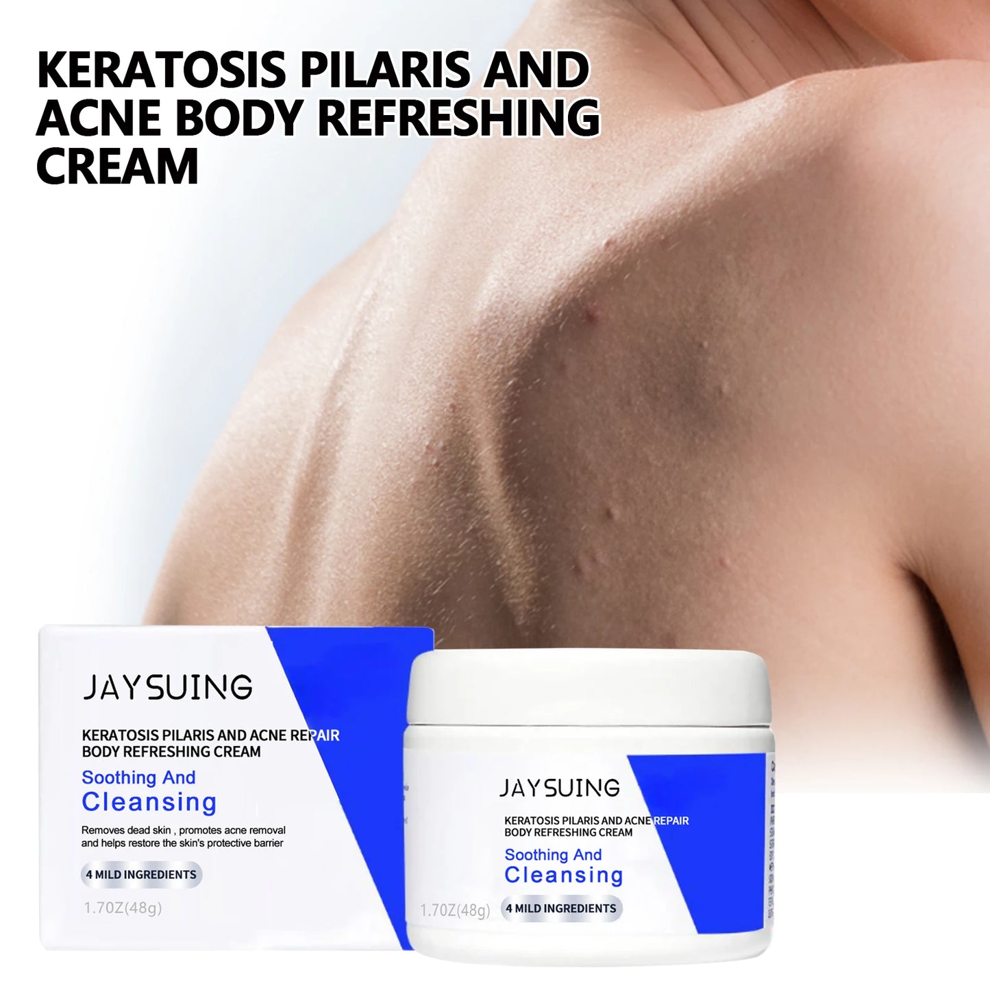 Keratosis Pilaris Repair Cream | Chicken Skin Body Lotion 48g