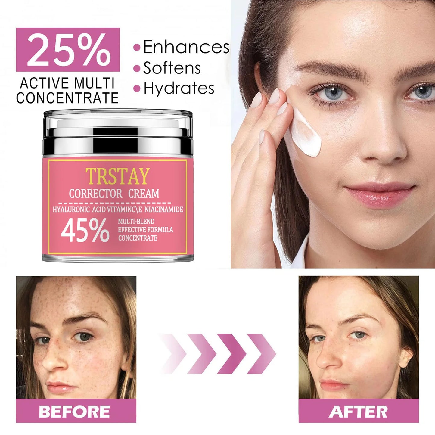 Dark Spot Remover for Face, Dark Spot Cream for Age Spot Sun Spot Freckles Melasma Brown Spot with Natural Formula, Dark Spot Co Peaceful Pleasures Health and Wellness