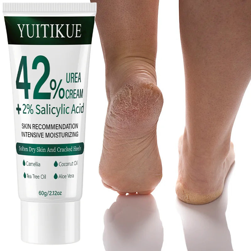 Yuitikue 42% Urea Cream with 2% Salicylic Acid, 60g Intensive Moisturizing Cream for Softening Dry Skin & Cracked Heels Peaceful Pleasures Health and Wellness