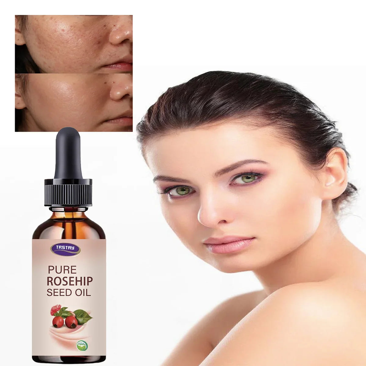 TRSTAY Pure Rosehip Seed Oil Face Serum – 5ml to 50ml