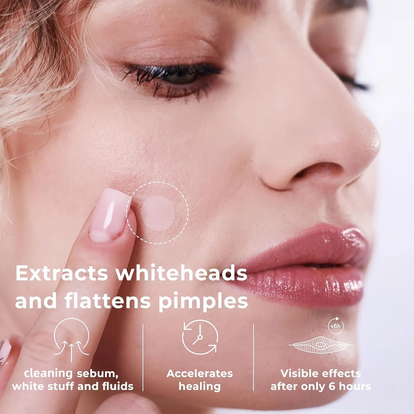 Invisible Waterproof Hydrocolloid Acne Patches – All Skin Types