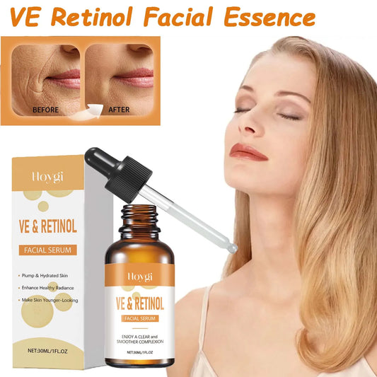Hoygi Retinol & Vitamin E Face Serum – Anti-Aging 30ml Retinol Face Serum Oasis Select