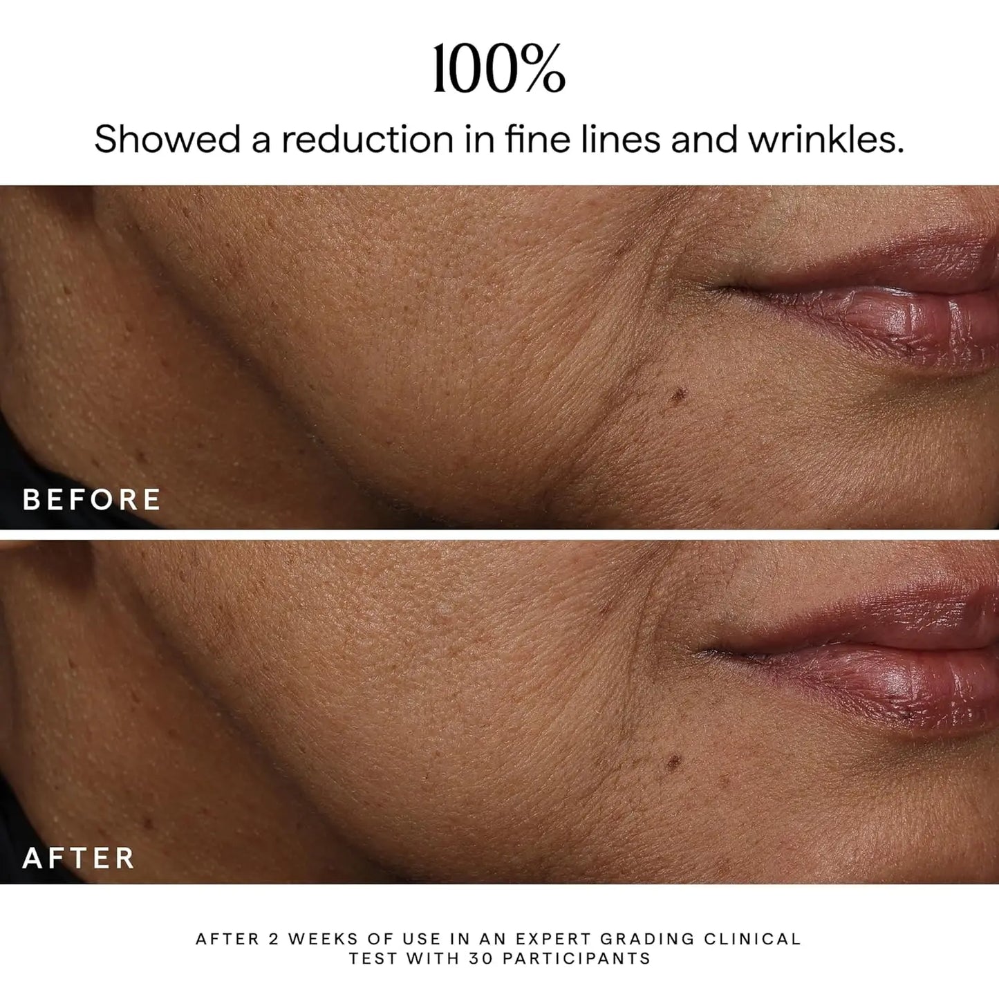 Bakuchiol Facial Rejuvenation Serum Anti Wrinkle Fade Fine Lines Firming Skin Elasticity Improve Radiance Face Hydrating Essence Peaceful Pleasures Health and Wellness