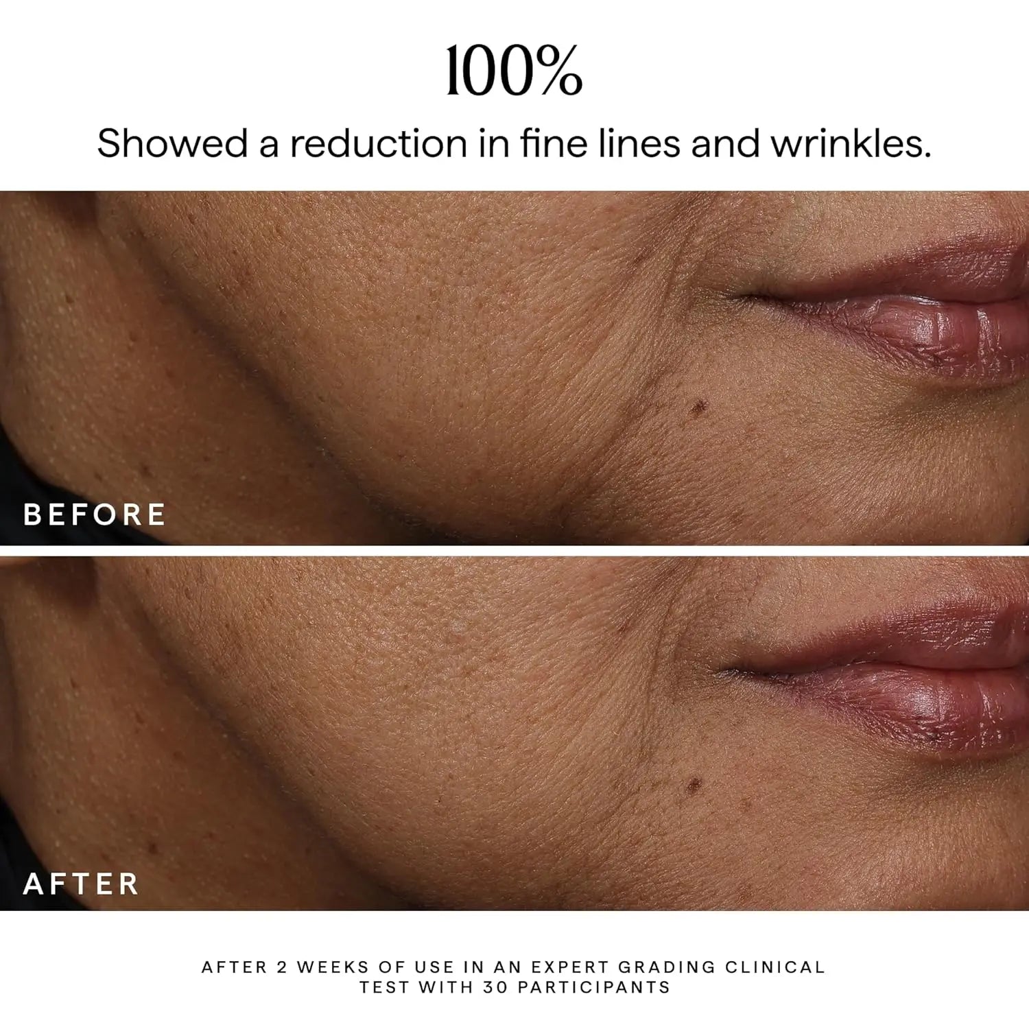 Bakuchiol Facial Rejuvenation Serum Anti Wrinkle Fade Fine Lines Firming Skin Elasticity Improve Radiance Face Hydrating Essence Peaceful Pleasures Health and Wellness