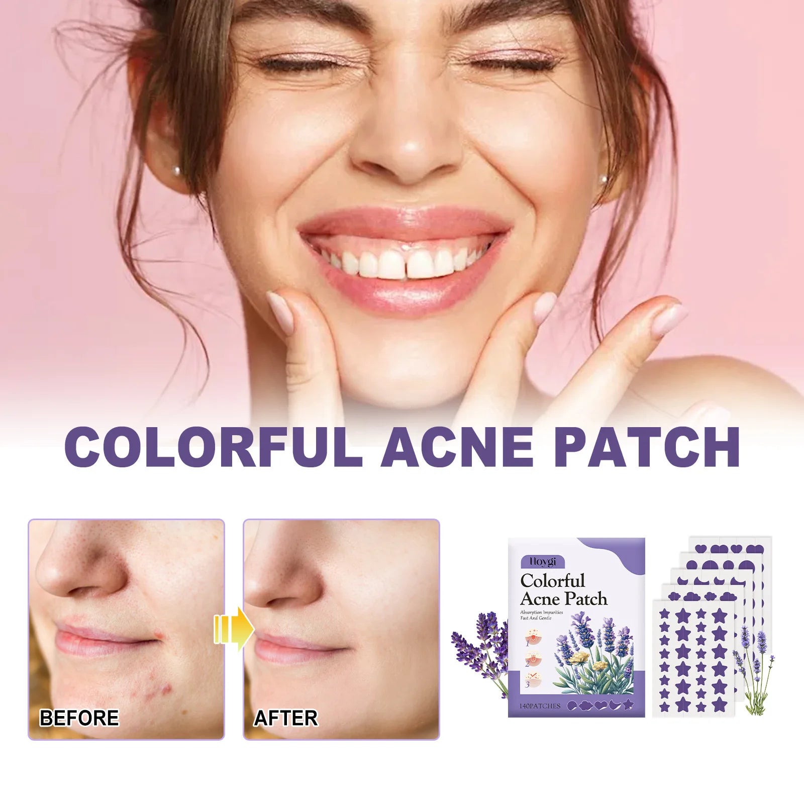 Acne Treatment Patch Absorbing Acne Cover Blemish Anti Infection Waterproof Spot Marks Concealer Colorful Pimple Removal Sticker Peaceful Pleasures Health and Wellness