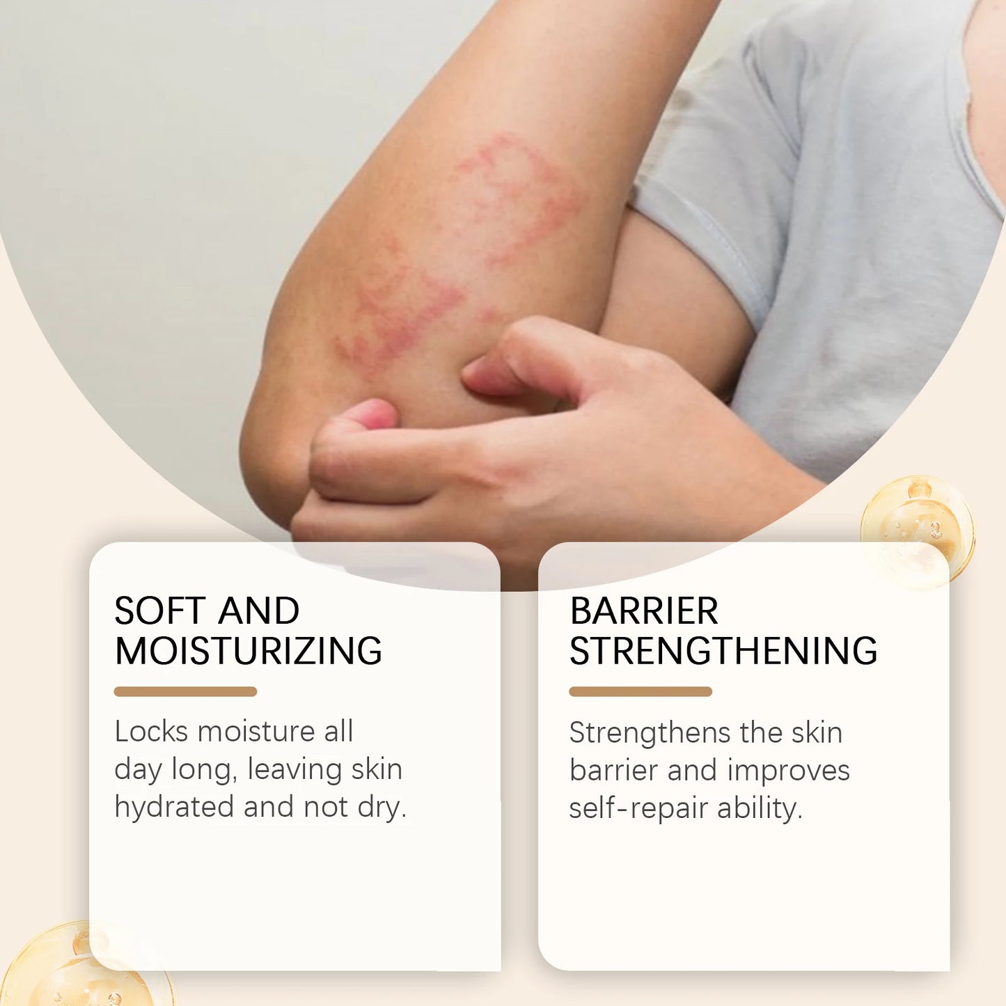 Ximonth Eczema Relief Cream – Moisturizing Skin Barrier Repair