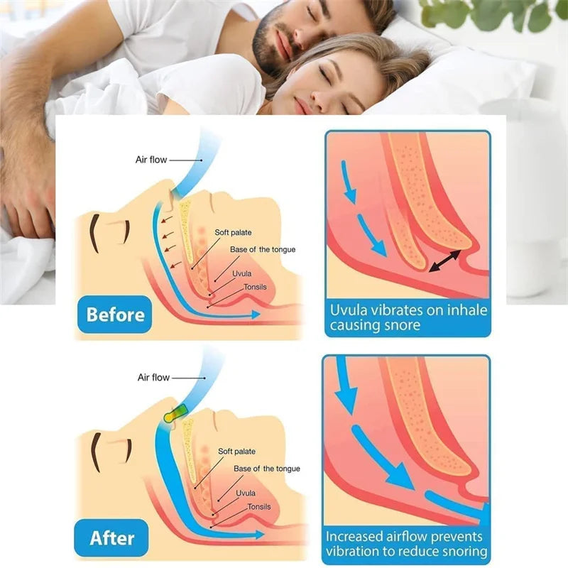 Silicone Magnetic Nose Clip Anti-Snore Sleep Aid with Case