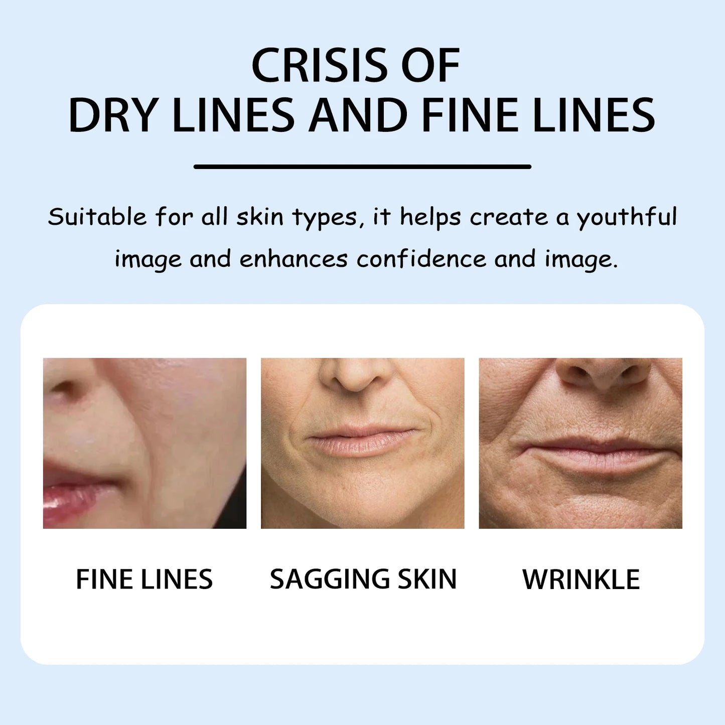 Nasolabial Fold Gel Patches – Anti-Wrinkle & Firming 10Pc