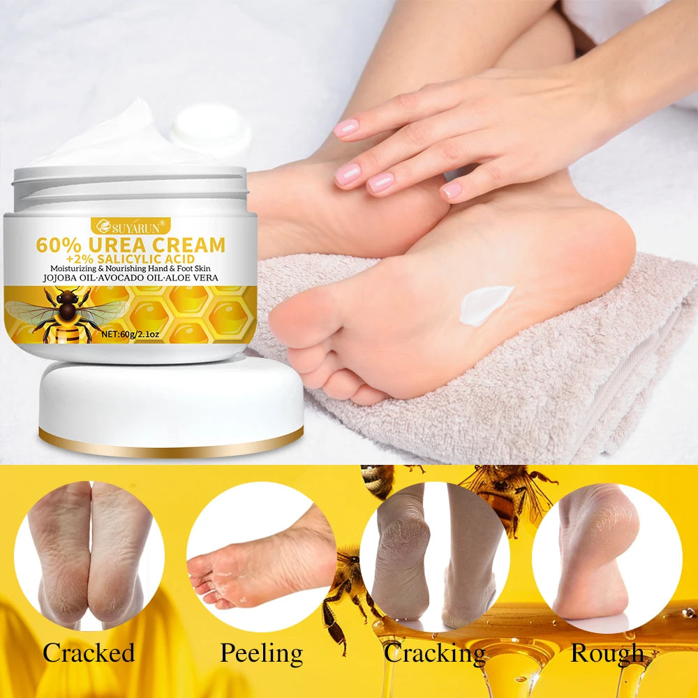 60% Urea & 2% Salicylic Acid Foot Cream for Cracked Heels - Exfoliating, Moisturizing, Hard Skin, Callus & Dead Skin Remover. Peaceful Pleasures Health and Wellness