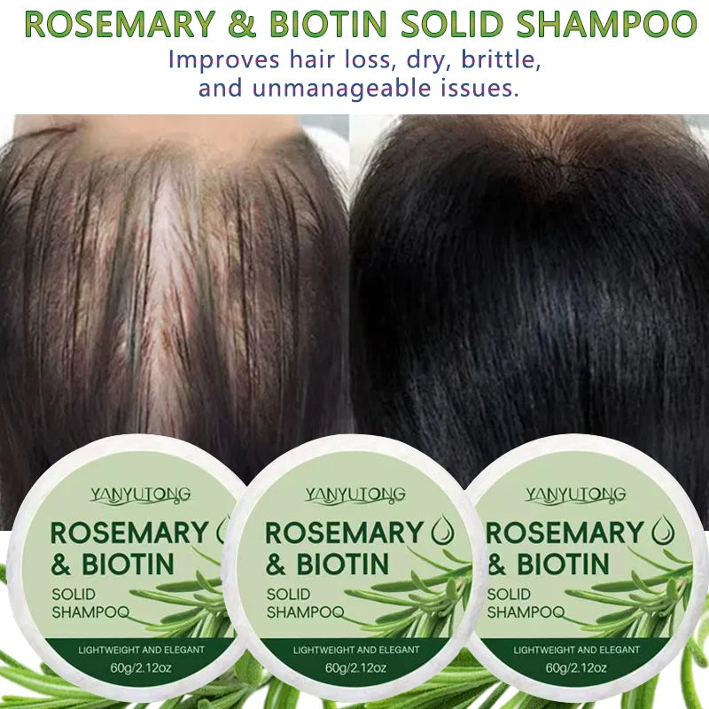 Rosemary Shampoo Bar – Scalp Relief, Oil Control & Hair Growth