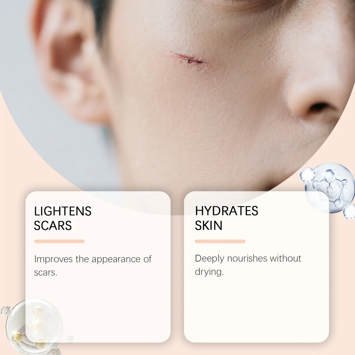 Silicone Scar Stick Acne Scar Reducing Redness Repair Blemishes Mild Formula Support Skin's Natural Repair Whitening Skin Care Peaceful Pleasures Health and Wellness
