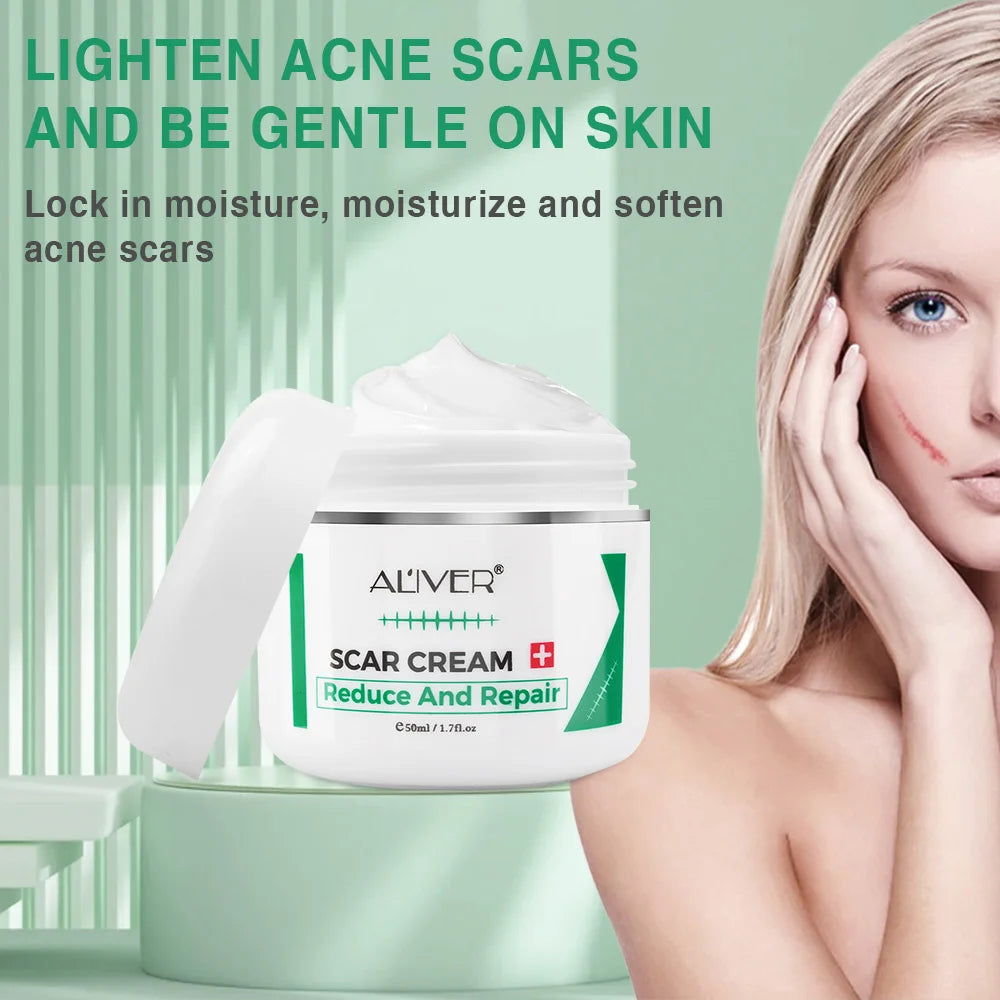 ALVER Acne Scar & Stretch Mark Remover Cream – 50ml Peaceful Pleasures Health and Wellness