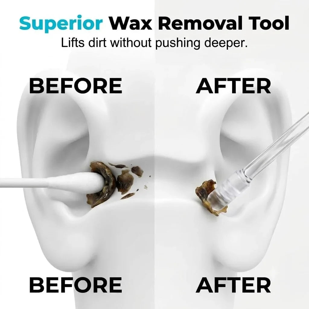 Sticky Ear Wax Remover Swabs – 24pc Disposable Kit