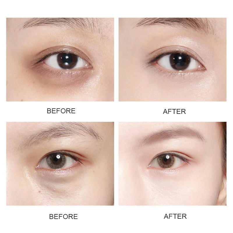 BIOAOUA Gold Collagen Eye Patches – Dark Circles & Puffiness