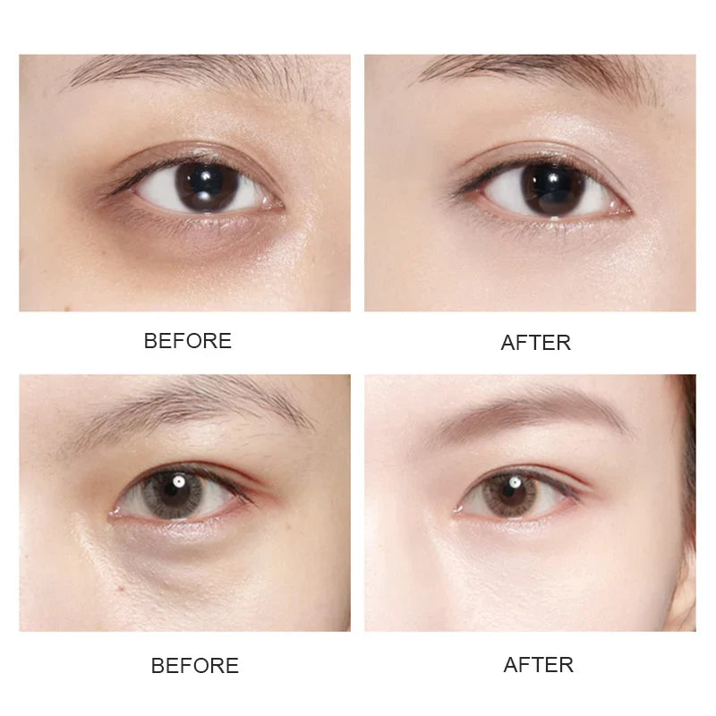 BIOAOUA Crystal Gold Collagen Eye Patches – Dark Circles