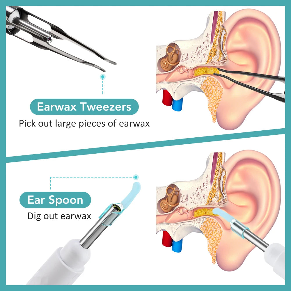 2 in 1 Visual Ear Wax Removal Tool with Camera and Tweezers 1080P HD WiFi Otoscope Reusable Ear Cleaner Kit for Kids Adults Pets Peaceful Pleasures Health and Wellness