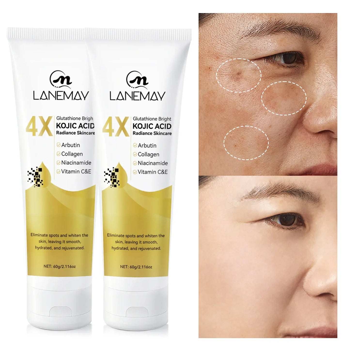 2-Pack Glutathione & Kojic Acid Brightening Cream 60g