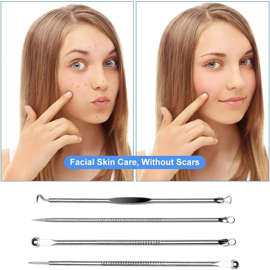 Acne Needle Remove Blackhead Comedone Extractor Tools Stainless Steel Facial Skin Care Tool Pimple Blemish Removal Tools Peaceful Pleasures Health and Wellness