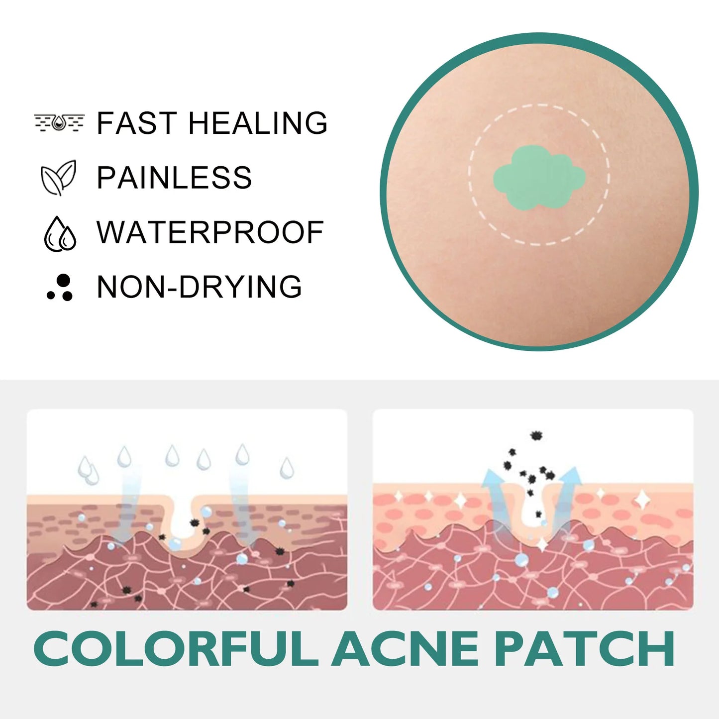 EELHOE Salicylic Acid Acne Patches 112pcs | Pimple Stickers