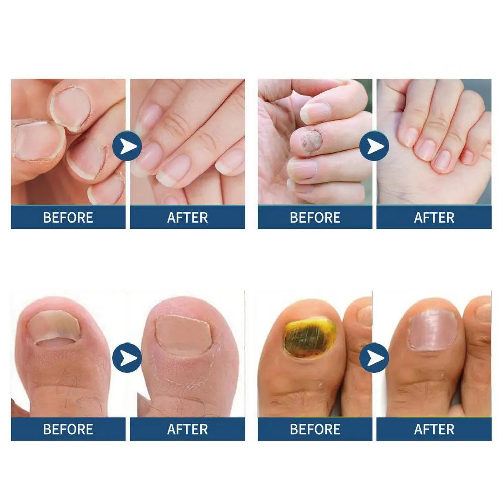 Overnight Nail Care Repair Patches – 3-Pack (32 pcs) Nail Care Peaceful Pleasures Health and Wellness