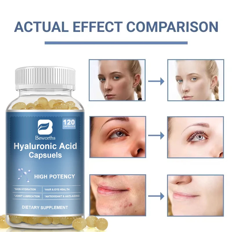 Hyaluronic Acid Capsules – Skin Hydration & Joint Flexibility Support Skin Care Supplement Peaceful Pleasures Health and Wellness