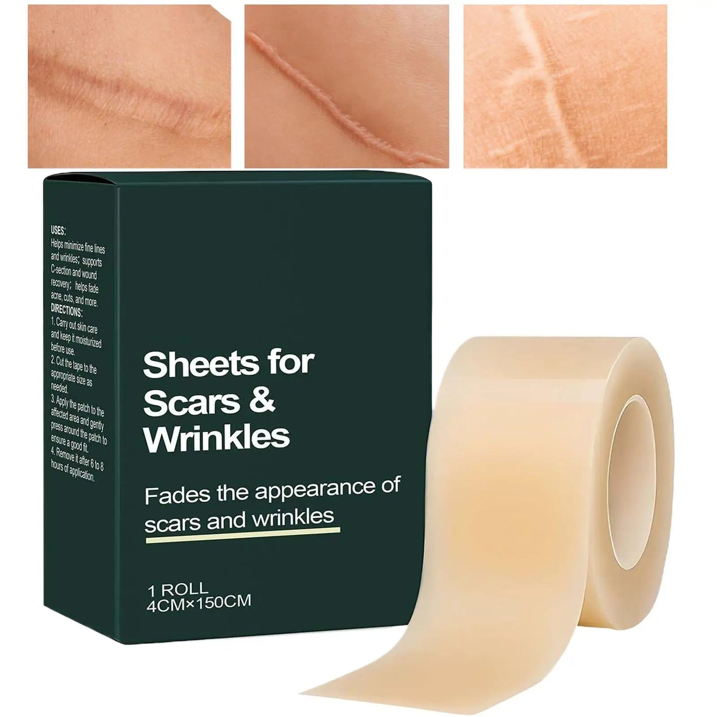 Silicone Scar Sheet Roll 4cm×150cm – Cuttable Skin Care Strip