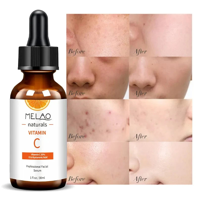 MELAO Vitamin C Serum – Hyaluronic Acid, Vitamin E Anti-Aging