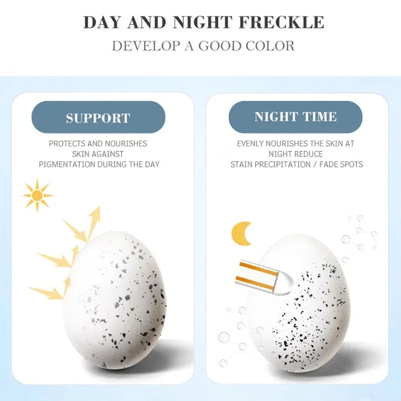 Effective Whitening Freckles Cream Remove Melasma Dark Spots Fade Melanin Pigmentation Moisturizing Brighten Skin Care Products Peaceful Pleasures Health and Wellness