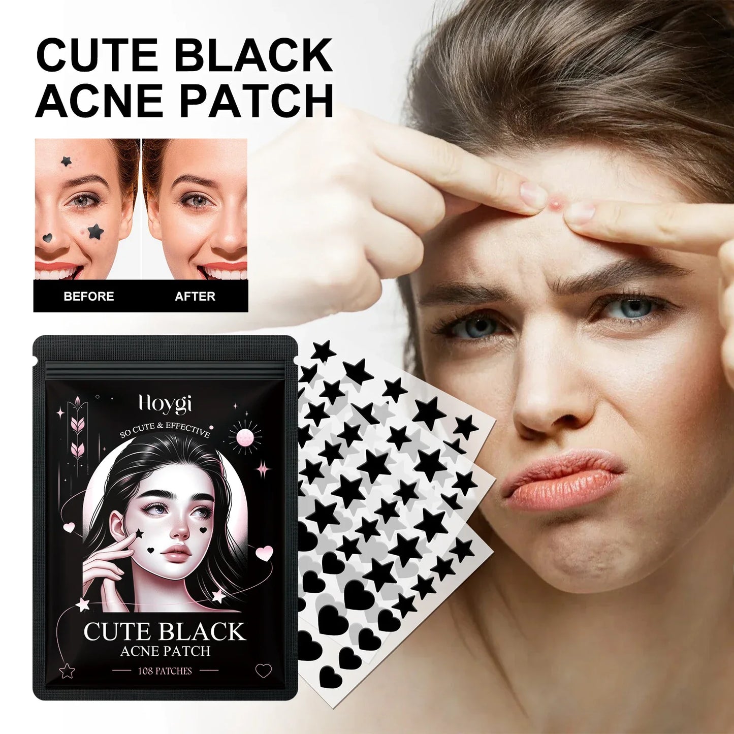 Hoygi Black Acne Patches – Spots, Blackheads & Blemish Care