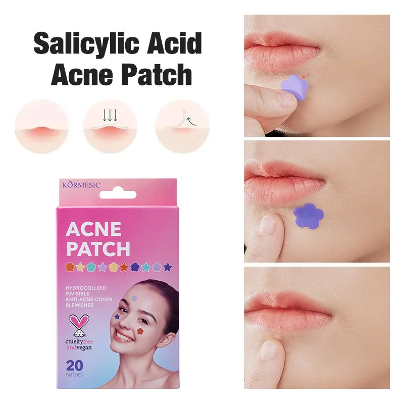 Colorful Star Acne Patches – Pimple & Blackhead Treatment 20pc