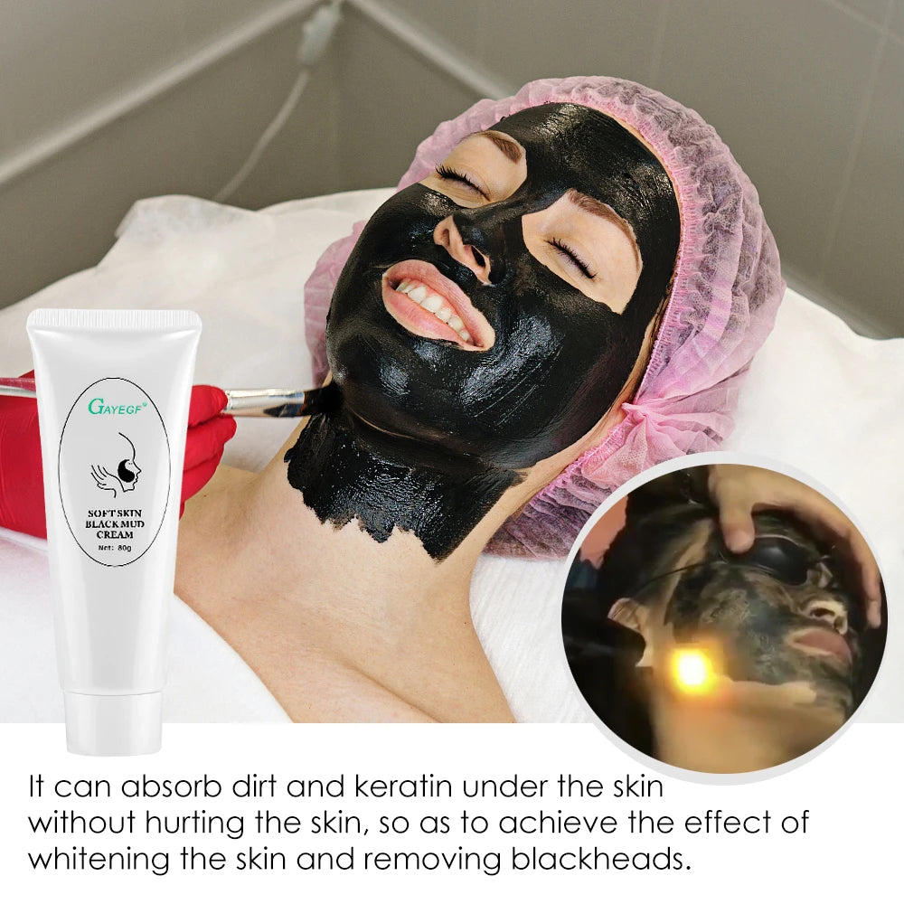 5/3 Carbon Gel Black Face Cream Mask Facial Deep Cleaning Support Laser Active Nano Toner Skin Rejuvenation Whitening Care Tool Peaceful Pleasures Health and Wellness
