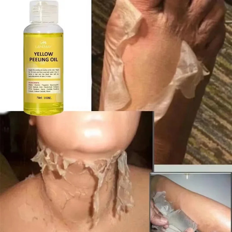 Yellow Peeling Oil – Exfoliate & Brighten Skin | 30ml