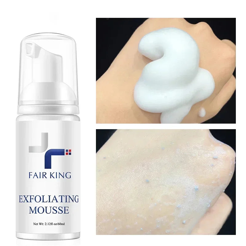 Exfoliating Cleansing Mousse | Pore Refining & Oil Control