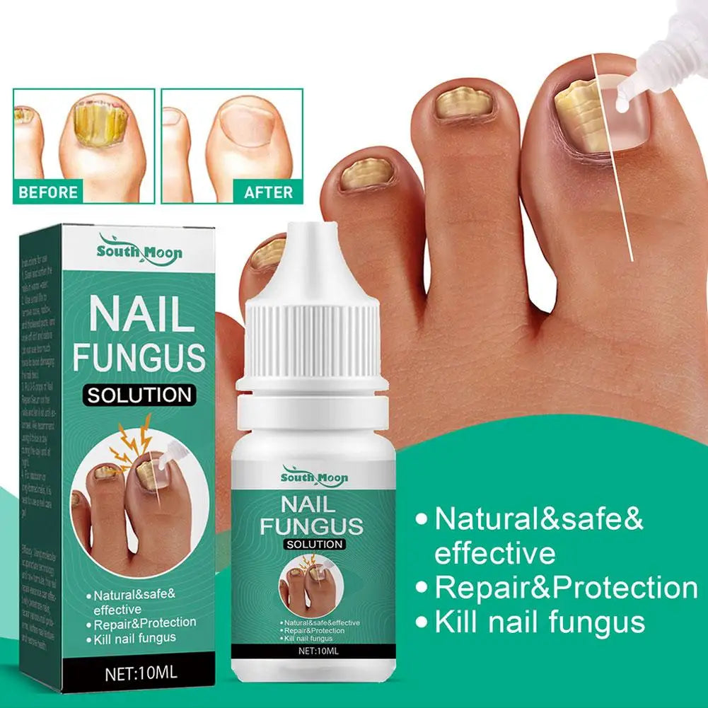 5-Pack Nail Repair Serum | Nail Restoration Essence 10ml