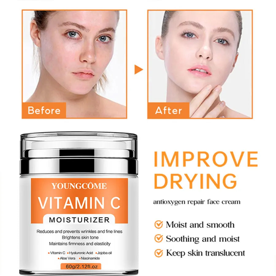 YOUNGCOME VitaminC Face Cream SkinCare Pigment Spots Freckles Remover Whitening Moisturizing Anit-Aging Beauty Health Cosmetics Peaceful Pleasures Health and Wellness