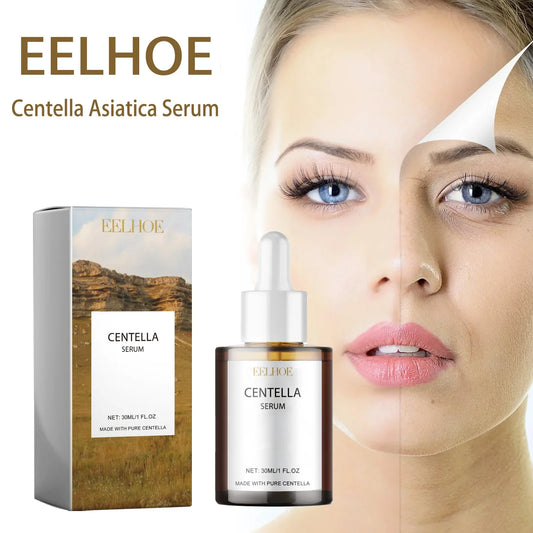 Eelhoe Centella Asiatica Cica Serum 30ml – Calming & Hydrating Cica Face Serum Oasis Select