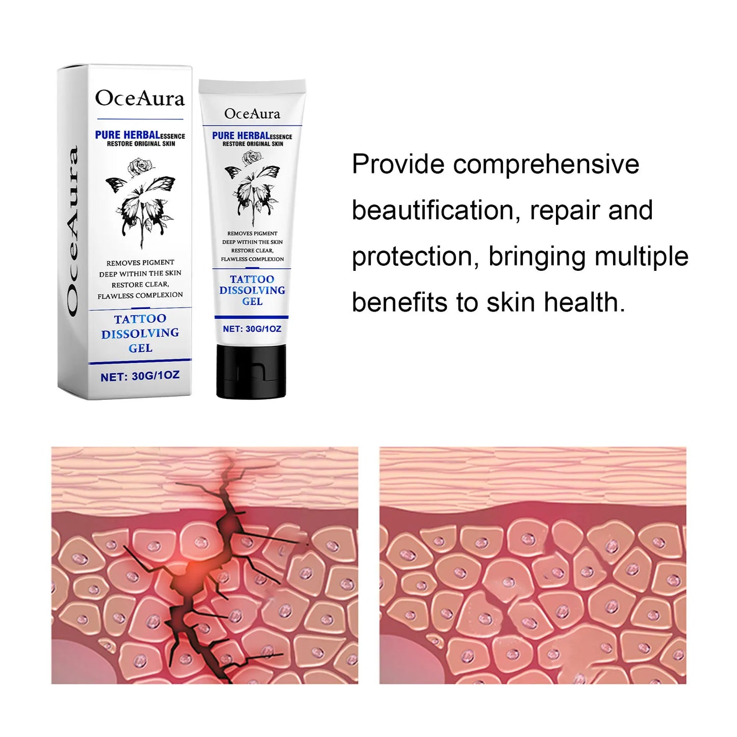 OceAura Tattoo Fading Gel – At-Home Ink Dissolving Cream