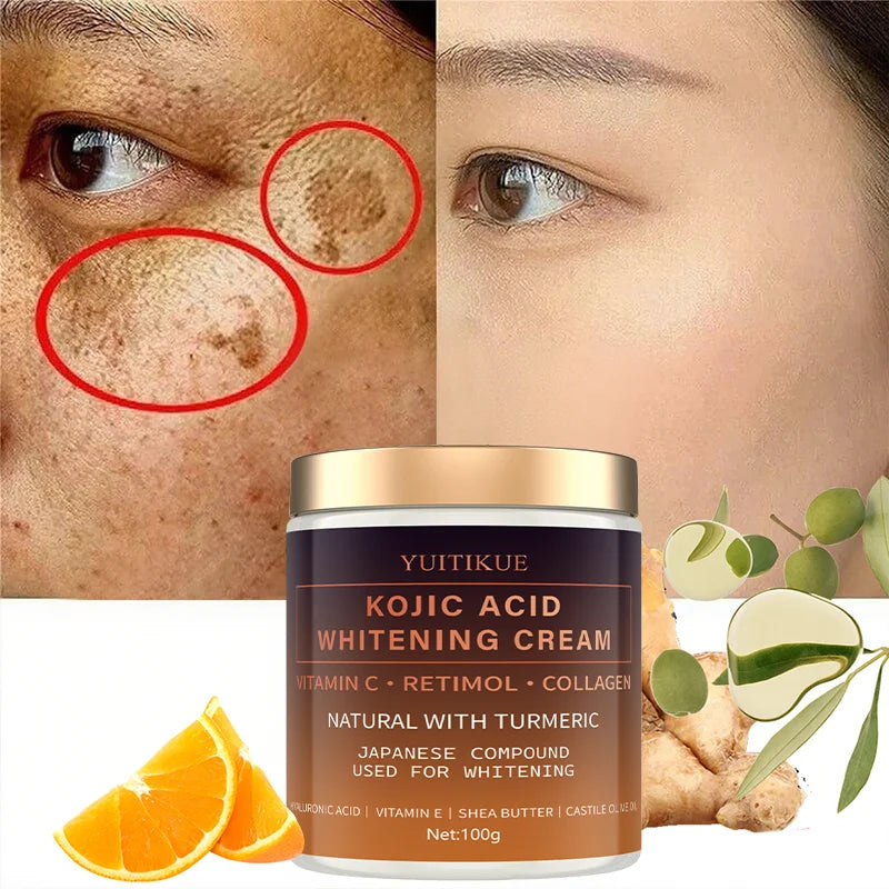 Kojic Acid Whitening Cream 100g | Vitamin C & Turmeric Brightener Skin Brightening Cream Peaceful Pleasures Health and Wellness