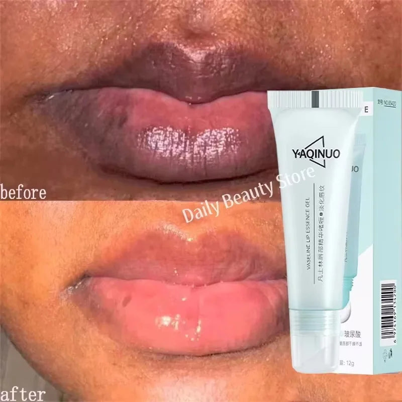 Eelhoe Lip Brightening Balm – Exfoliate, Hydrate & Restore