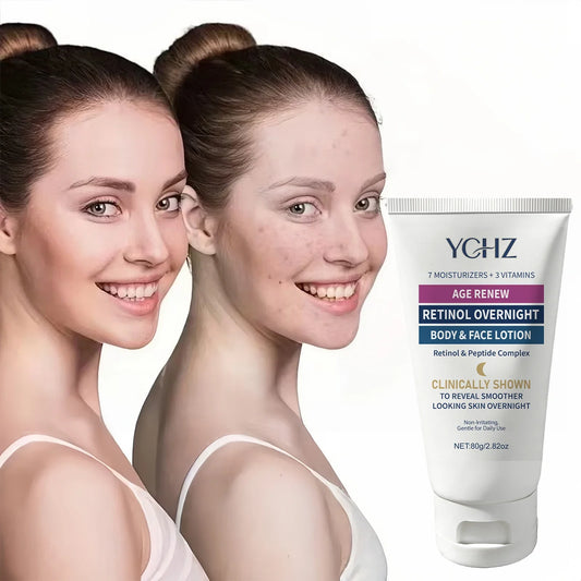 Retinol Peptide Body Lotion – Hyaluronic Acid & Vitamin E Body Moisturizer Lotion Oasis Select